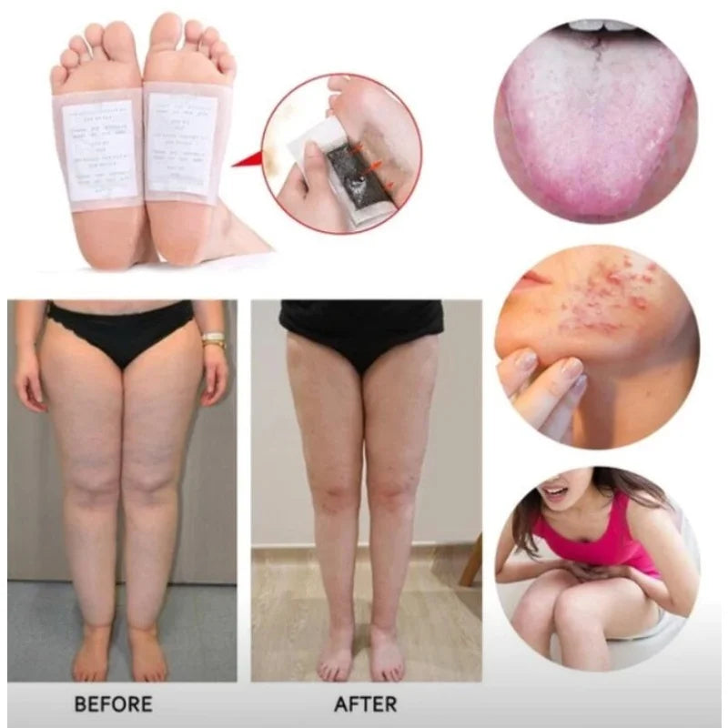 Parches Relajantes para Pies con Artemisa (10 pares) – Descanso Nocturno