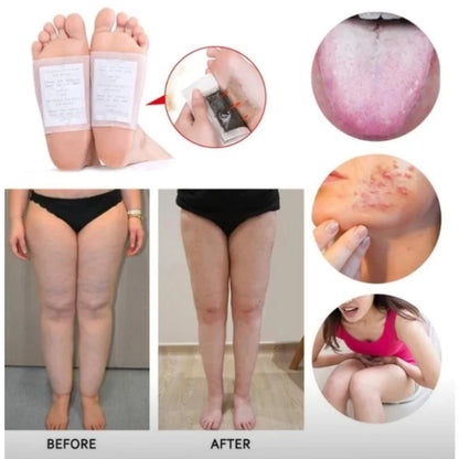 Parches Relajantes para Pies con Artemisa (10 pares) – Descanso Nocturno