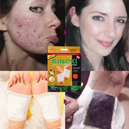 Parches Relajantes para Pies con Artemisa (10 pares) – Descanso Nocturno